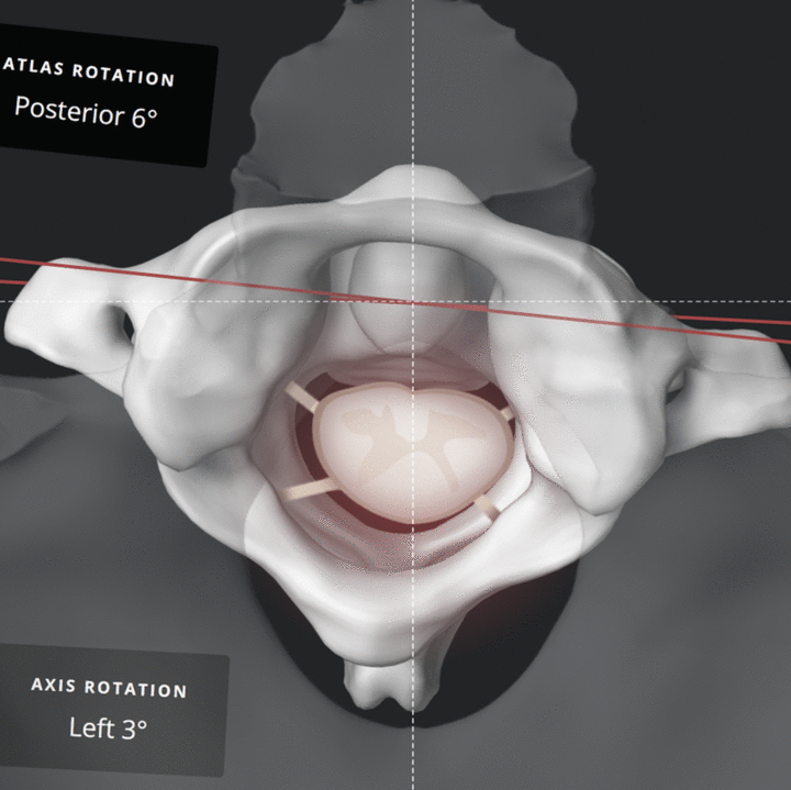 Precision vertex imaging used in NUCCA analysis